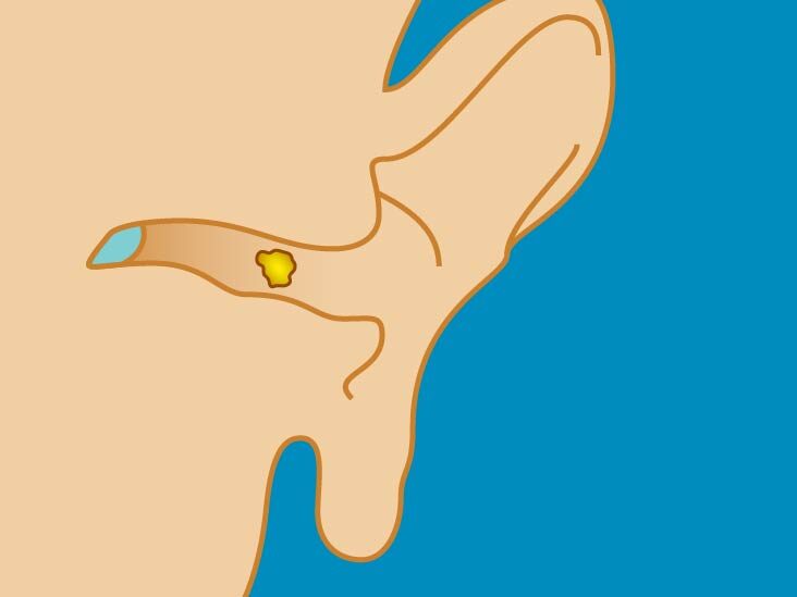 ear