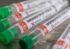 Monkeypox virus detected in three more countries