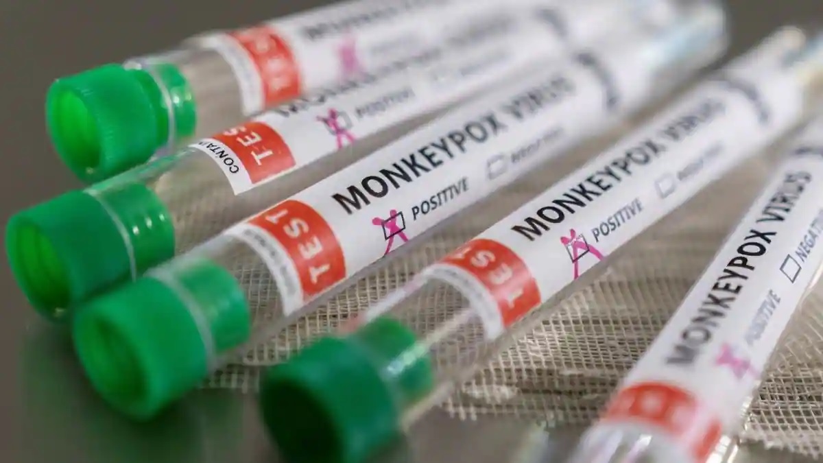 Monkeypox virus detected in three more countries