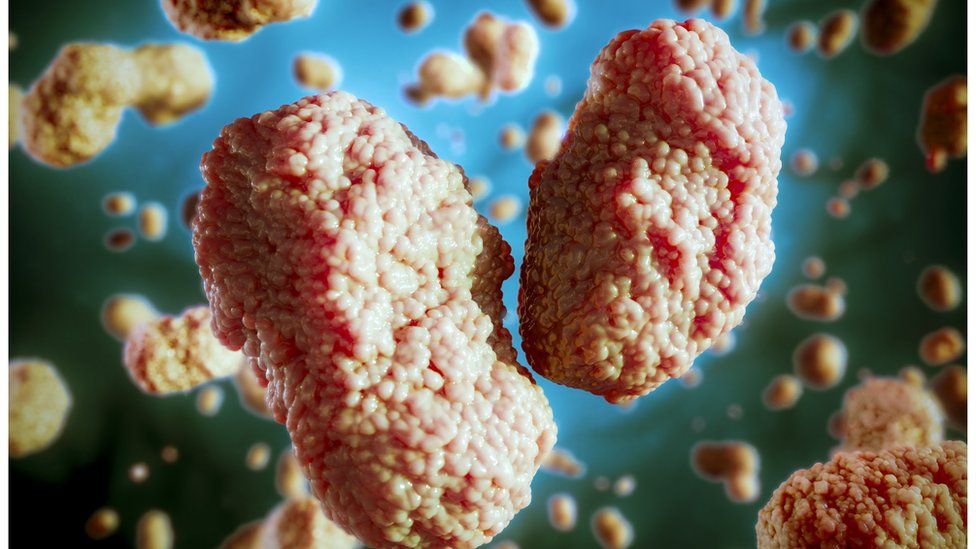 Monkeypox virus detected in three more countries