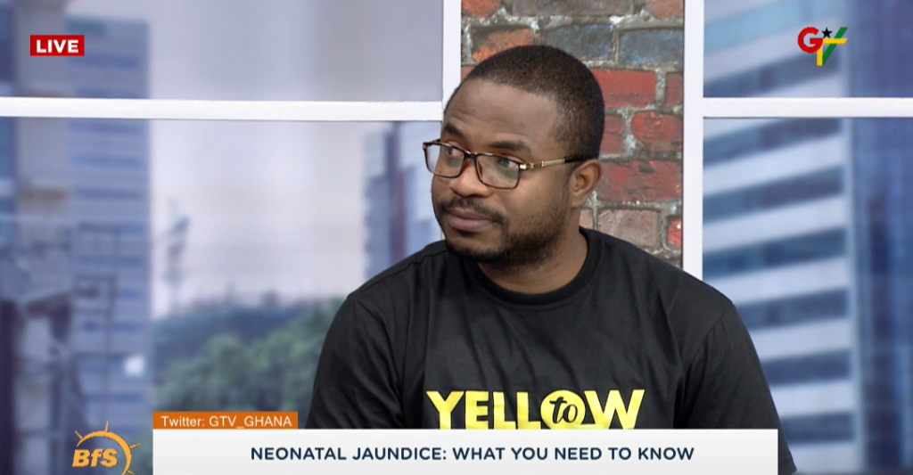 Pressing breast milk into baby's eye, not proven cure for jaundice - Pediatric Specialist