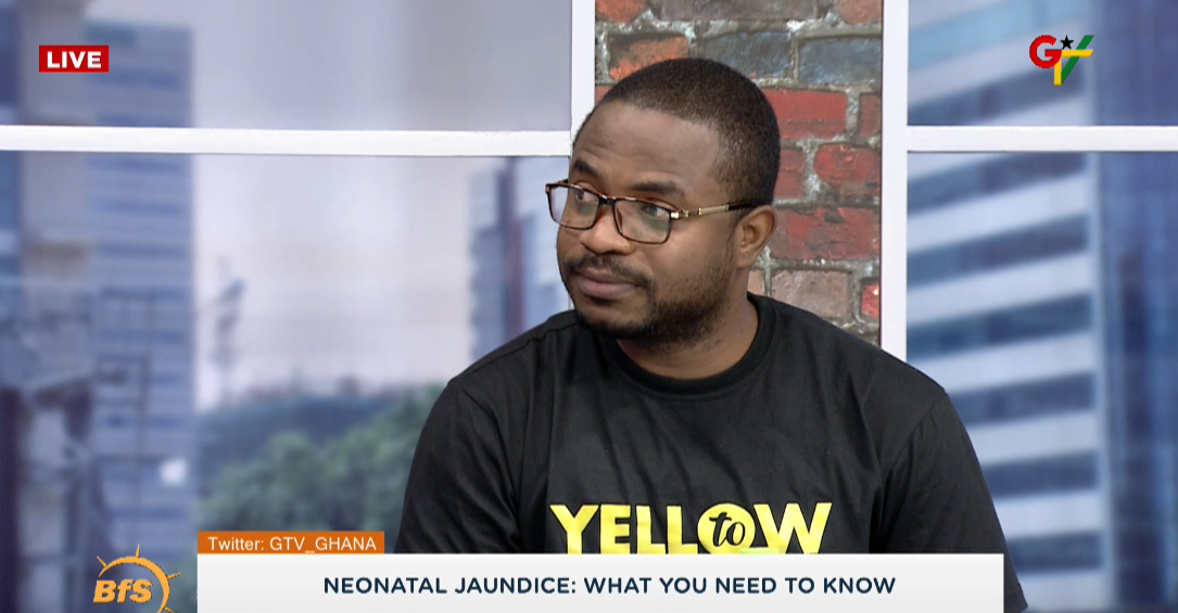 Pressing breast milk into baby's eye, not proven cure for jaundice - Pediatric Specialist