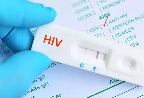 HIV Self-Testing receives high patronage
