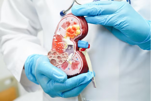 Early Detection: The Lifeline Against Kidney Disease