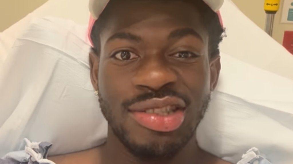 Lil Nas X in hospital with partial face paralysis