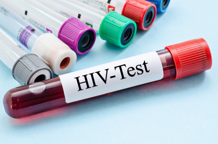 More HIV patients not on treatment – New report reveals